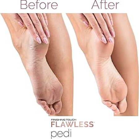ELECTRONIC PEDICURE TOOL